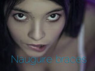 Nauguire_braces
